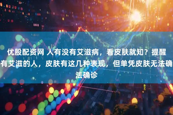 优股配资网 人有没有艾滋病，看皮肤就知？提醒：有艾滋的人，皮肤有这几种表现，但单凭皮肤无法确诊
